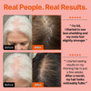 Hair Care Serum with Massage Brush Applicator – Thickening & Hair Regrowth Scalp Treatment for Fuller, Stronger Hair