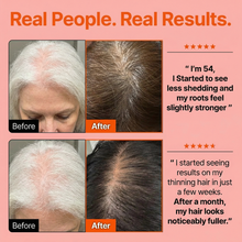Hair Care Serum with Massage Brush Applicator – Thickening & Hair Regrowth Scalp Treatment for Fuller, Stronger Hair